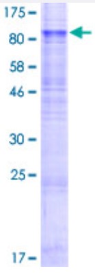 SDS PAGE (SLC1A2-22H).jpg